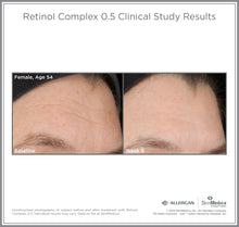 Load image into Gallery viewer, The forehead of a female, age 54, who used the SkinMedica Retinol Complex 0.5 for 8 weeks. Her skin appears healthier and has less wrinkles.
