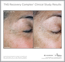 Load image into Gallery viewer, Before and after photos of a female, age 60, who used the SkinMedica TNS Recovery Complex for 6 months. Her skin appears much healthier.
